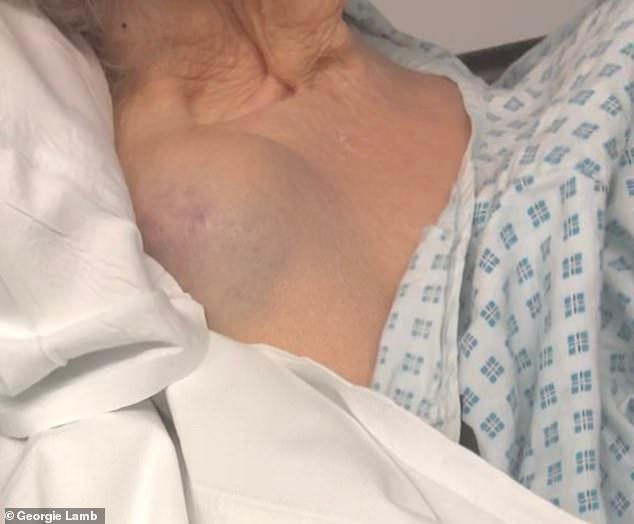 英国95岁二战女英雄抗住了战争炮火，却在护理院遭虐待颅骨骨折