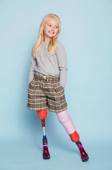 英9岁女孩先天残疾双腿截肢，父亲为其打造超模人生登上纽约T台