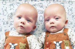 英女子怀上双胞胎，生下一个孩子竟停止分娩，