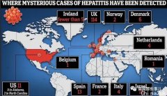 英国十一4例！稀有儿童肝炎在欧美传布，10多儿童急需肝移植！缘故不明！重点关注这些症状！