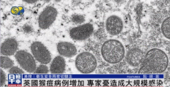 英国猴痘病例减少至57例，专家：将来几周内病例数将大幅回升